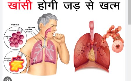 खांसी के सटीक घरेलू नुस्खे: स्वास्थ्य के लिए प्राकृतिक उपाय