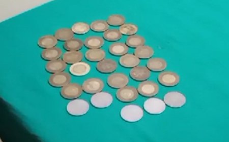 हिमाचल में युवक के पेट से निकले 33 सिक्के:ऑपरेशन के बाद युवक स्वस्थ्य, 247 ग्राम वजन के 300 रुपए निगले थे
