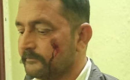 हिमाचल में दो समुदाय में झड़प, 3 घायल:हिंदू नेता ने दूसरे समुदाय पर हमले के आरोप लगाए, बोले- शिवरात्रि के भंडारे का किया विरोध