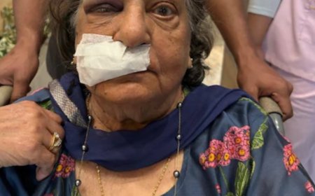 एअर-इंडिया ने 82 साल की महिला को व्हीलचेयर नहीं दिया:एयरपोर्ट परिसर में गिरी, होंठ से खून बहा, सिर-नाक पर चोट आई; दो दिन से ICU में