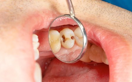 World Oral Health Day 2025: दांतों के कीड़ों को कुछ ही दिनों में खत्म कर देगा किचन में मौजूद ये छोटा सा मसाला