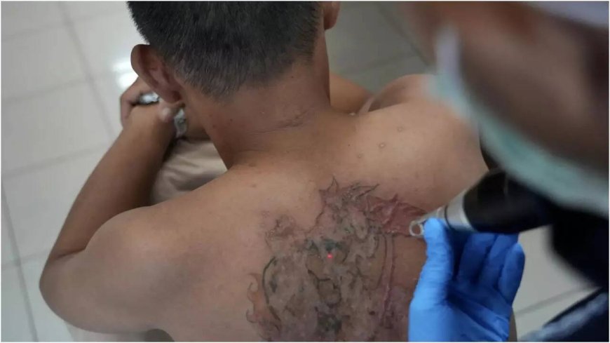 Faith over ink: Indonesians seek free tattoo removal during Ramzan