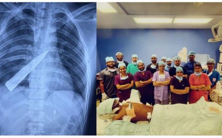 सीने में टूटा चाकू, नहीं टूटी उम्मीद: केजीएमयू में दूरबीन विधि से युवक की जान बचाई