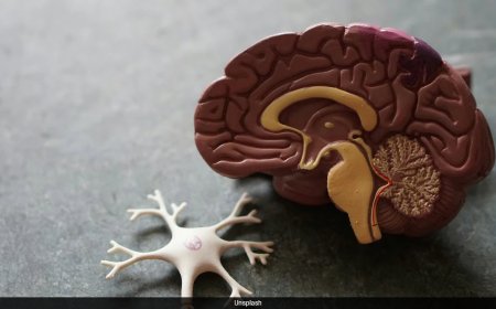 डॉक्टर ने बताया रोज सुबह अगर खा लिया यह सूखा मेवा तो कभी नहीं पड़ेगी दिमाग के डॉक्टर की जरूरत, बढ़ेगी ब्रेन पावर