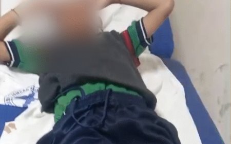 शिमला में आवारा कुत्तों ने बच्चे को किया लहूलुहान:स्कूल जाते समय किया हमला, मेयर कार्यालय के बाहर धरने पर बैठे पिता