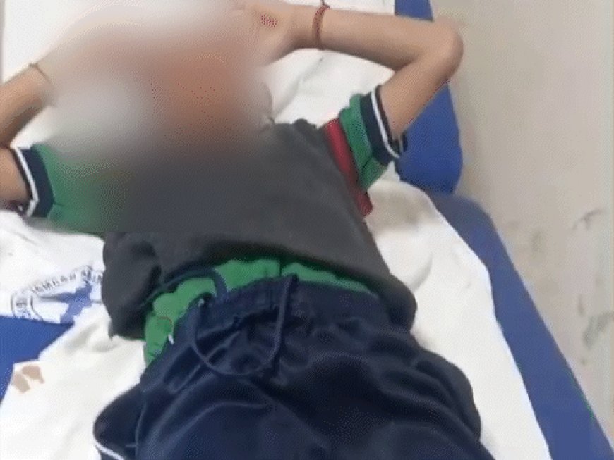 शिमला में आवारा कुत्तों ने बच्चे को किया लहूलुहान:स्कूल जाते समय किया हमला, मेयर कार्यालय के बाहर धरने पर बैठे पिता