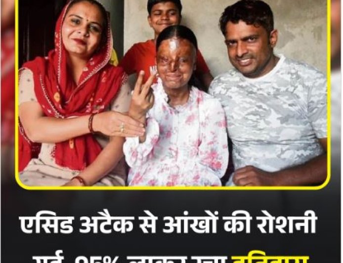 CBSE बोर्ड परिणाम: तेजाब हमले की शिकार 'काफी' ने रचा इतिहास, 12वीं में 95.6% अंक लाकर बनी टॉपर