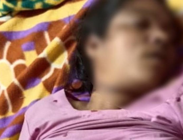 ऊना में दो महिलाओं ने किया सुसाइड:एक ने दुपट्टे से फंदा लगाया, दूसरे ने जहर खा कर दी जान