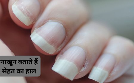 Nail Health Tips: नाखून का टूटना या पीला पड़ना, ये संकेत बताते हैं हमारी सेहत को लेकर बहुत कुछ