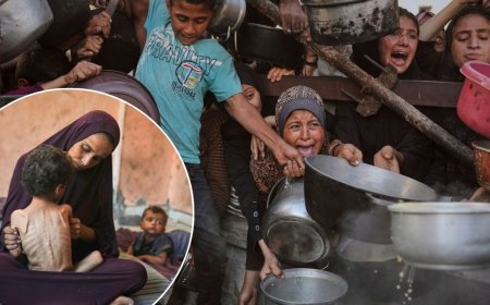 गाजा में बड़ा होता जा रहा भूखमरी का संकट, लोग ही नहीं पत्रकार भी चपेट में, किसकी सुनेगा इजराइल?