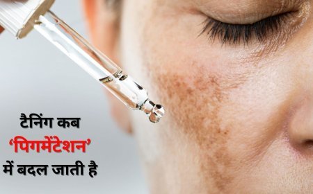Skin Care Tips: टैनिंग कब पिगमेंटेशन में बदल जाती है, एक्सपर्ट से जानें