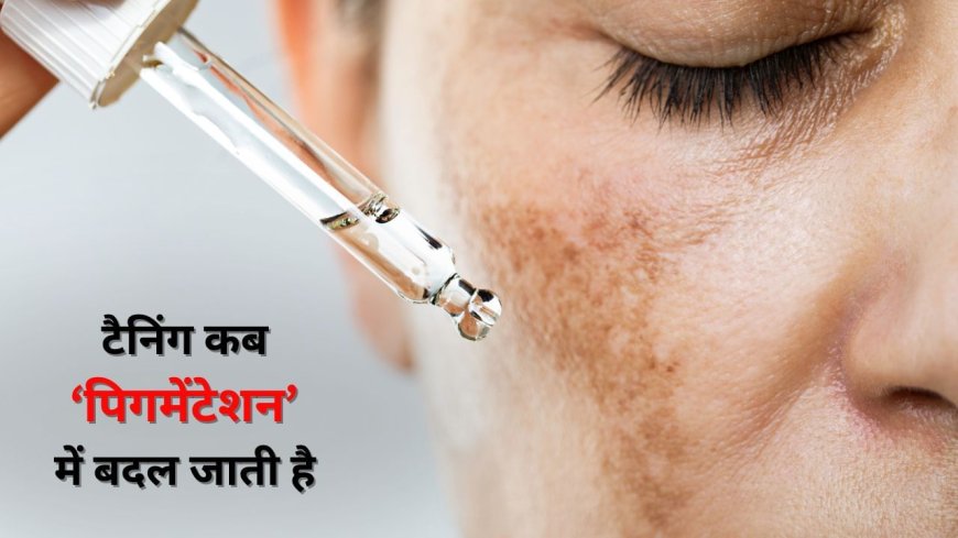 Skin Care Tips: टैनिंग कब पिगमेंटेशन में बदल जाती है, एक्सपर्ट से जानें