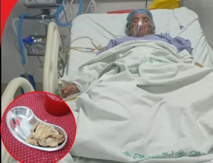 कोख से बच्ची निकाली और पेट में छोड़ दिया सर्जिकल नैपकिन ! खरगोन में गायनोकॉलोजिस्ट की जानलेवा लापरवाही