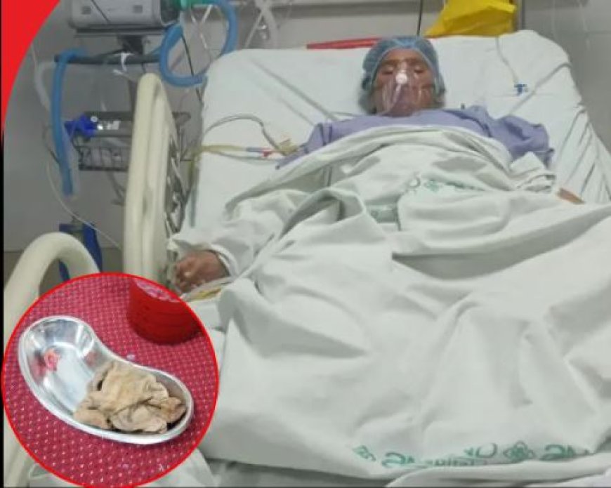 कोख से बच्ची निकाली और पेट में छोड़ दिया सर्जिकल नैपकिन ! खरगोन में गायनोकॉलोजिस्ट की जानलेवा लापरवाही